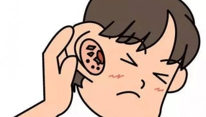 耳朵总是痒，却什么都挖不出，怎么回事？