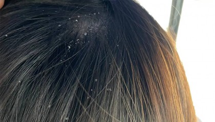 国产的洗发水有哪几种?