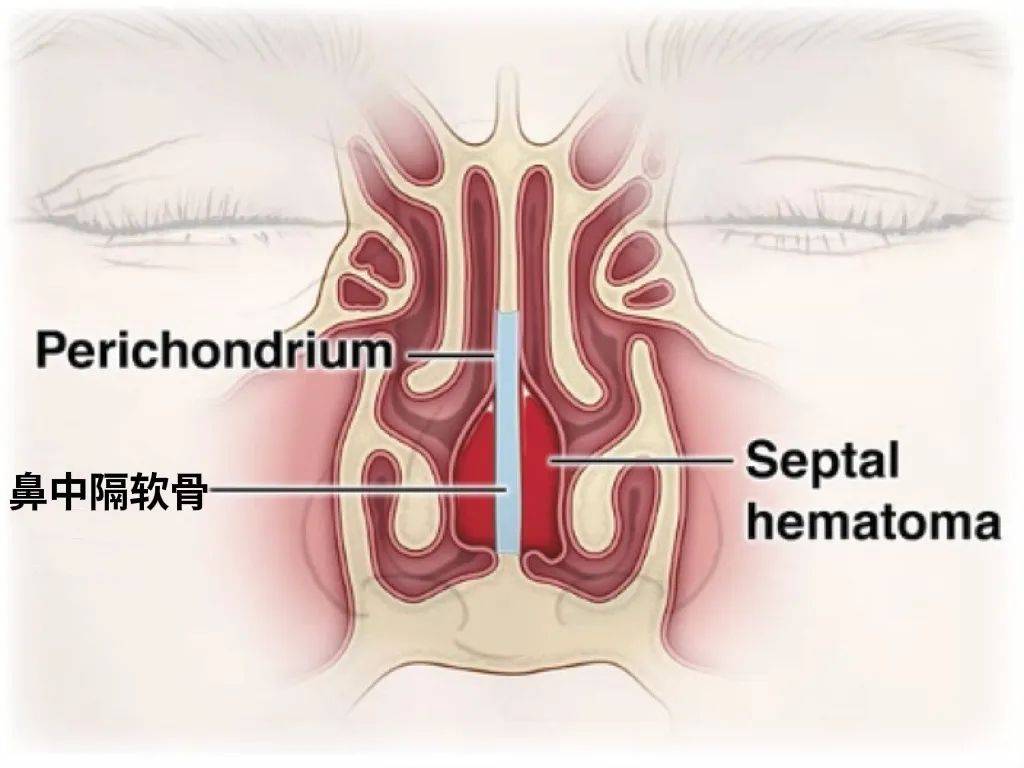 长期挖鼻孔的人，后来都怎么样了