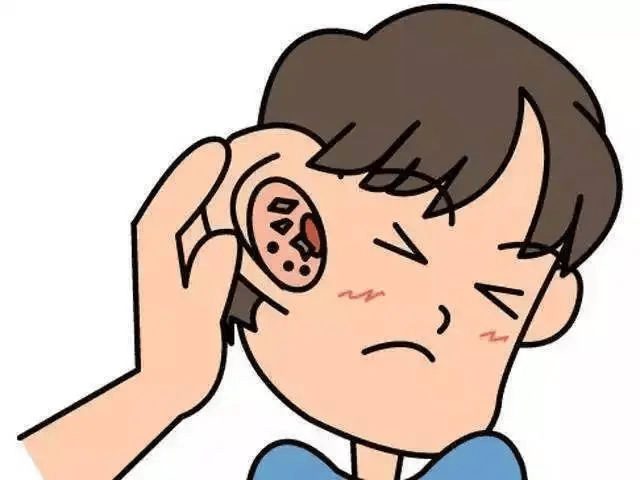 耳朵总是痒，却什么都挖不出，怎么回事？
